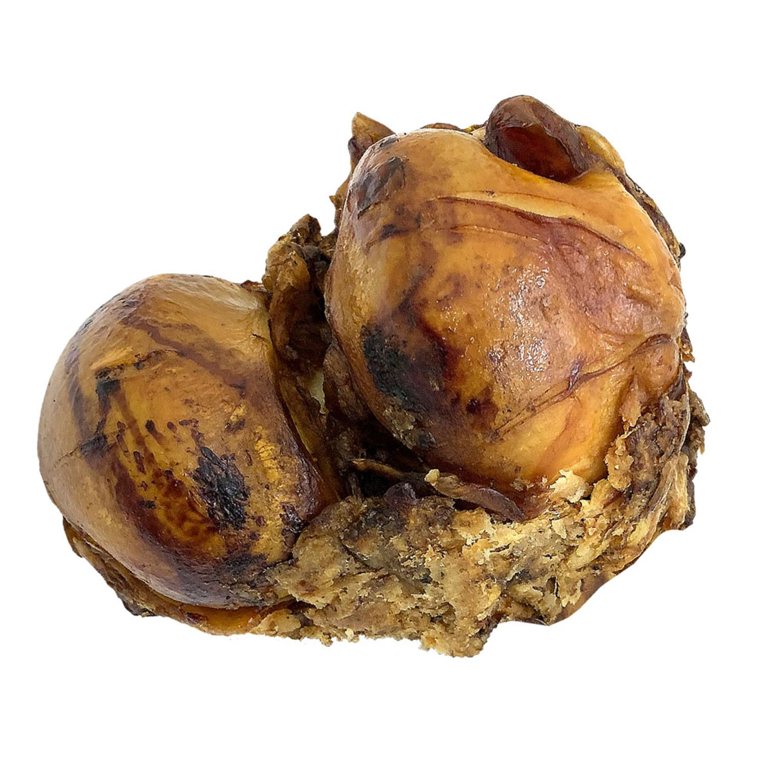 Cabeca-do-Femur_1